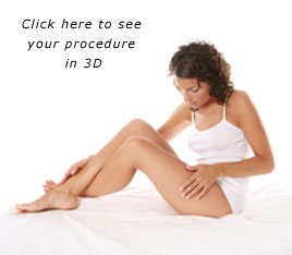 Click here to see your procedure in 3D